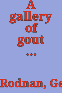 A gallery of gout : being a miscellany of prints and caricatures from the 16th century to the present day / by Gerald P. Rodnan.